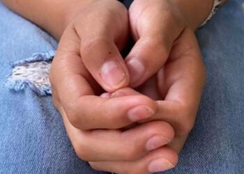 ‘Tengo mucho mareo, se me va la respiración y la comida me da asco’, niños intoxicados en Chiapas viven con secuelas