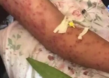 Camión cae sobre colmena de abejas; el enjambre mató a 4 pasajeros