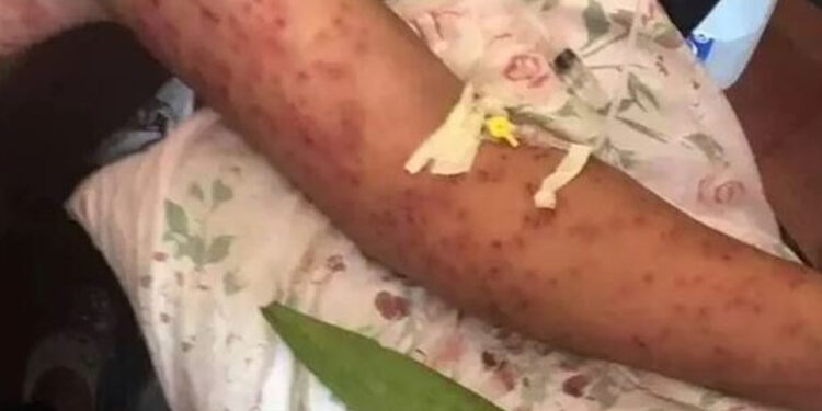 Camión cae sobre colmena de abejas; el enjambre mató a 4 pasajeros