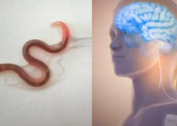 Extraen lombriz intestinal VIVA de 8 centímetros del cerebro de mujer australiana