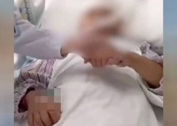 “Su cerebro casi sale”: profesora destroza la cabeza a una niña con una regla de metal