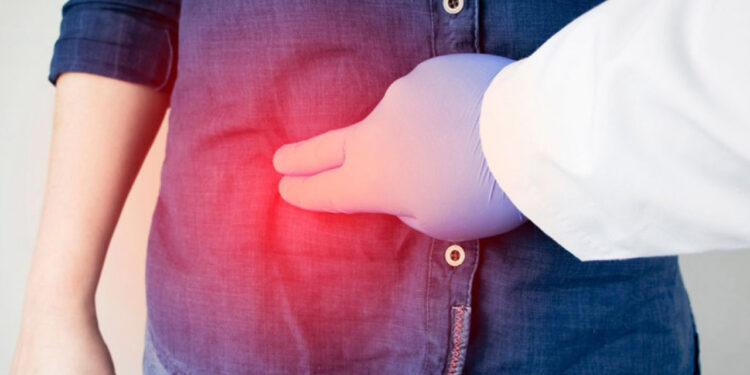 ¿Los corajes dañan tu vesícula? ¿Mito o realidad?