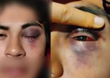 Denuncian brutal golpiza contra jóvenes en el bar “Una y ya” por no pagar propina