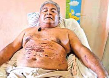 Sobrevivió a ‘Otis’, pese a hundirse a bordo de su barco; se le reventaron venas oculares