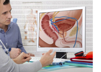 Uno de Cada 6 Hombres Será Diagnosticado con Cáncer de Próstata: Expertos