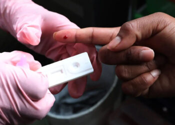 Cofepris autoriza autoprueba para detección de VIH