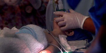 Pequeño de 1 año ingiere diésel e ingresa al hospital por intoxicación grave en los Mochis, Sinaloa