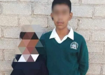 Estudiante de telesecundaria pierde la vista de un ojo tras ser agredido con cal en Tlacolula