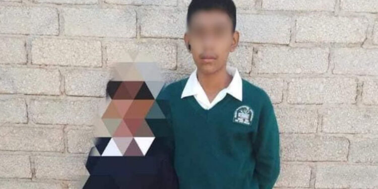 Estudiante de telesecundaria pierde la vista de un ojo tras ser agredido con cal en Tlacolula