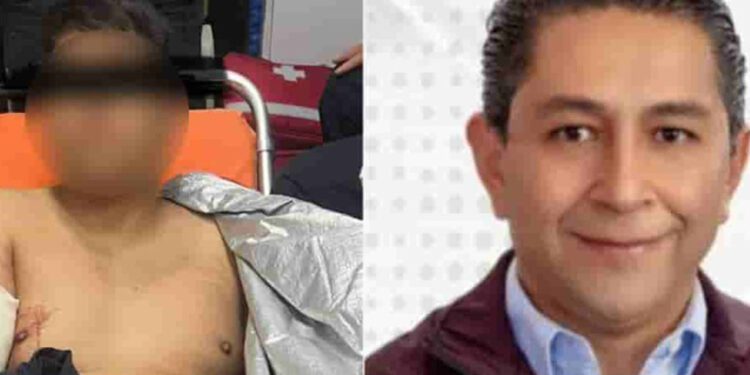 Balean a hijo de candidato a presidente municipal de Metepec, Edomex