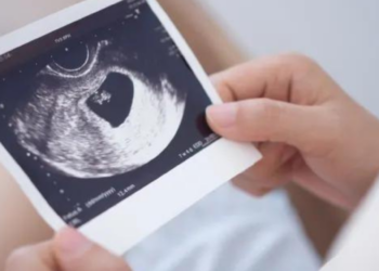 Iglesia pide leyes que den opciones a mujeres embarazadas y no solo el aborto