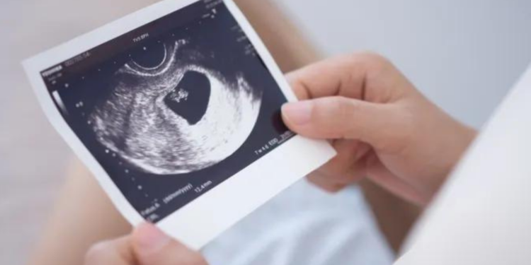 Iglesia pide leyes que den opciones a mujeres embarazadas y no solo el aborto