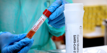 OMS alerta por aumento de casos de covid-19; hay riesgo de que surja una cepa más virulenta