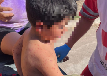Muere niño de 6 años luego de ser picado por más de 100 abejas en Los Mochis