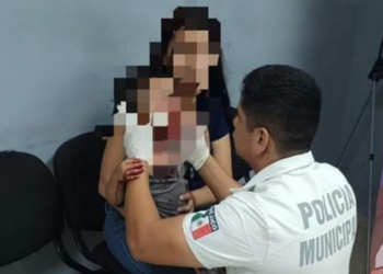 Perro ataca a un menor de un año en Sonora