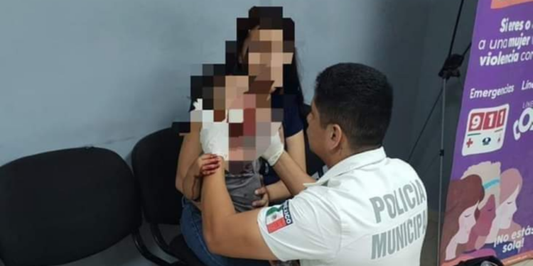 Perro ataca a un menor de un año en Sonora