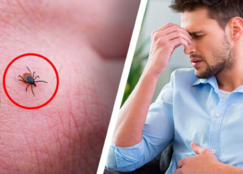 Alertan por rickettsia, enfermedad que causa la MUERTE; ¿Qué es y cuáles son sus síntomas?