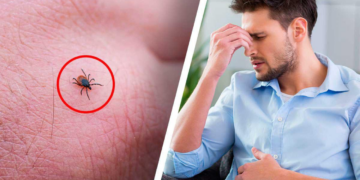 Alertan por rickettsia, enfermedad que causa la MUERTE; ¿Qué es y cuáles son sus síntomas?