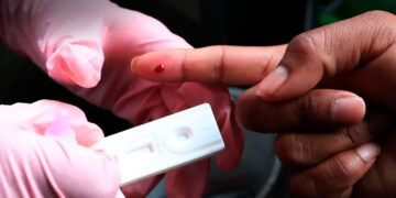 Organizaciones piden a Sheinbaum un plan ante más de 17 mil casos de VIH en México