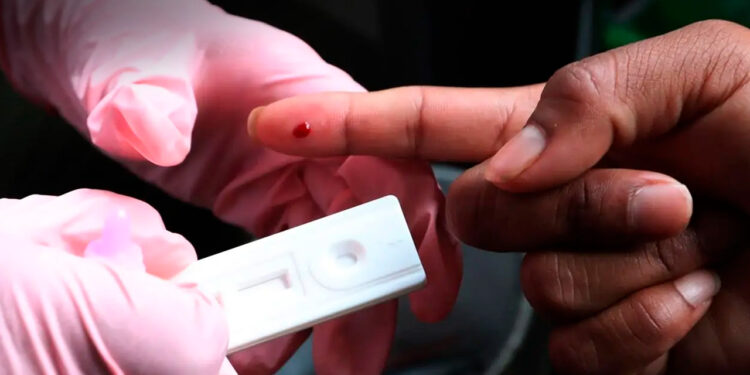 Organizaciones piden a Sheinbaum un plan ante más de 17 mil casos de VIH en México