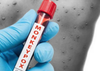 Viruela del mono: 3 mitos de la enfermedad que fueron desmentidos por las autoridades