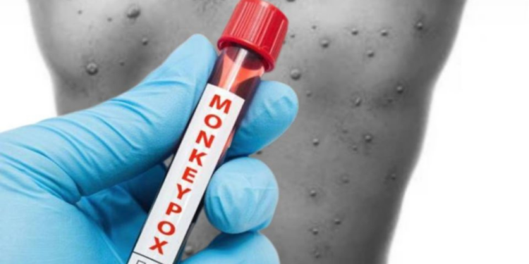 Viruela del mono: 3 mitos de la enfermedad que fueron desmentidos por las autoridades