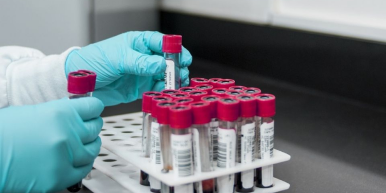 MAL: descubren nuevo grupo sanguíneo tras 50 años de investigaciones
