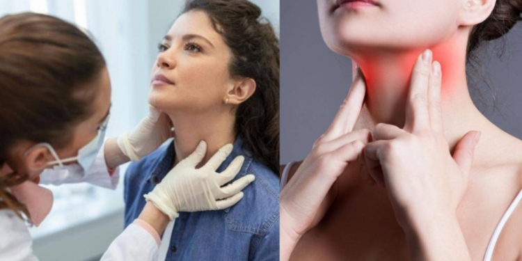 Cáncer de tiroides es más frecuente en mujeres, afirma endocrinóloga