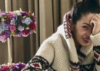Yolanda Andrade habla por primera vez de su reciente crisis de salud: “tuve una situación con mi cerebro”