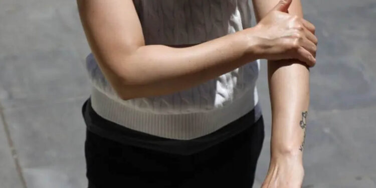 Enfermedades dermatológicas también empeoran con el cambio climático