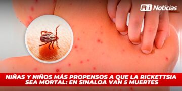 Niñas Y niños más propensos a que la Rickettsia sea mortal: En Sinaloa van 5 muertes