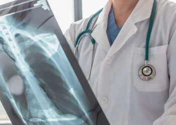 ¿Qué estudios te debes de hacer para prevenir el cáncer de pulmón?