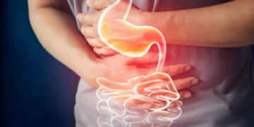 Al menos la mitad de la población en México padece estreñimiento, alerta especialista