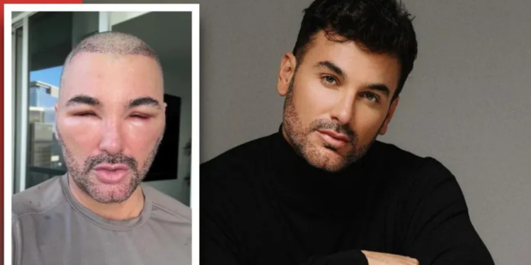 Rostro de Mauricio Mejía, querido actor mexicano, causa terror en redes por radical cambio; ¿Qué le pasó?