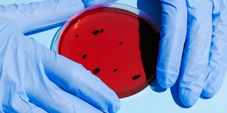 Bacteria Klebsiella Oxytoca: ¿cuáles son sus síntomas?