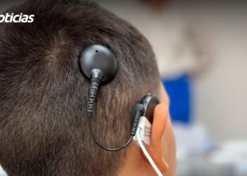 El Hospital Pediátrico de Sinaloa, sin lista de espera para implantes cocleares