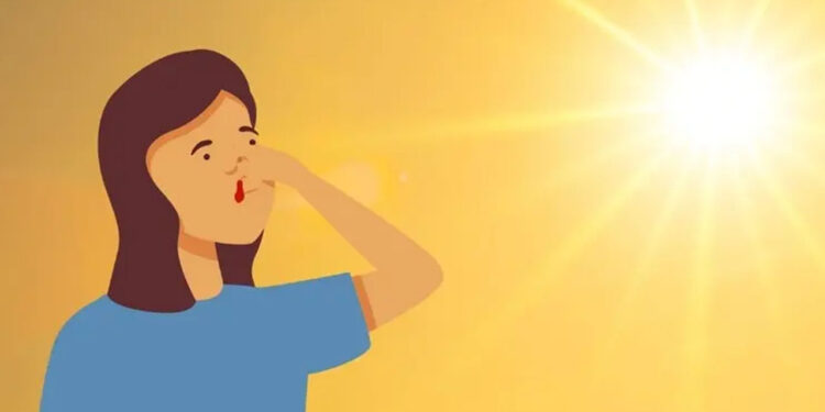 ¿Por qué nos sale sangre de la nariz cuando hace calor?