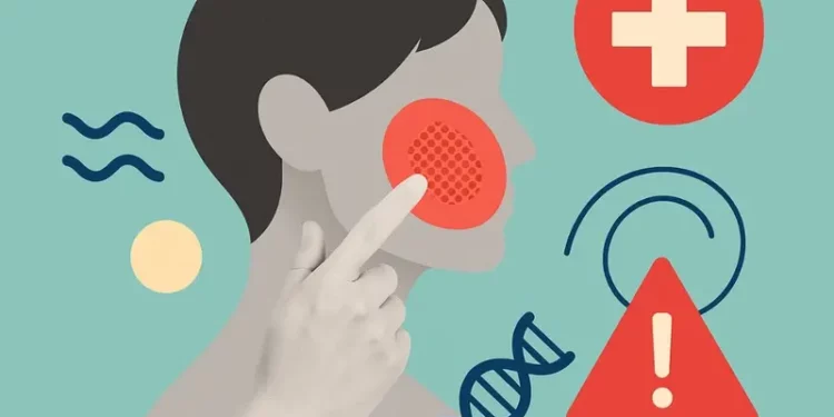 ¿Vives con hinchazón sin explicación? Podría ser una enfermedad rara que pasa desapercibida