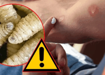 Secretaría de Salud detecta 6 casos de miasis humana por gusano barrenador