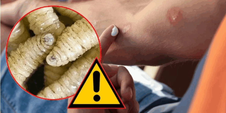 Secretaría de Salud detecta 6 casos de miasis humana por gusano barrenador