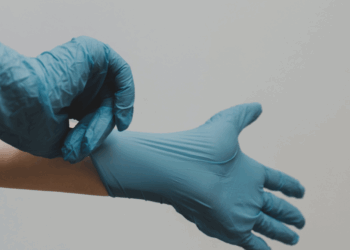 Se disparan casos de viruela del mono en México; suman 174