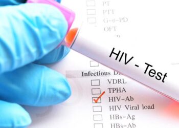 Incrementan los casos de VIH hasta en un 15% en Mazatlán