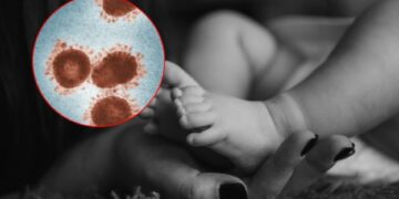 56 bebés de menos de un año han muerto por tos ferina en 2025