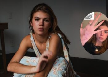 Valentina Gilabert responde a hate en redes y revela cómo ha sido su recuperación: “Mucha fisioterapia y mucho esfuerzo”