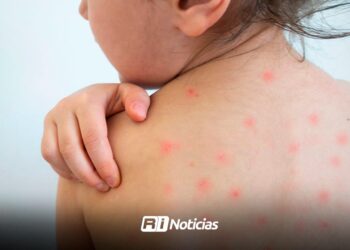 En Sinaloa brote de sarampión suma 12 casos; anuncian mega jornada de vacunación en Juan José Ríos