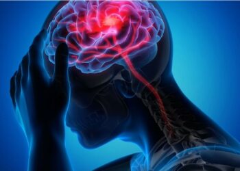 ¿Qué es un infarto cerebral? estos son los alimentos que reducen el riesgo de infartos cerebrales