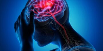 ¿Qué es un infarto cerebral? estos son los alimentos que reducen el riesgo de infartos cerebrales