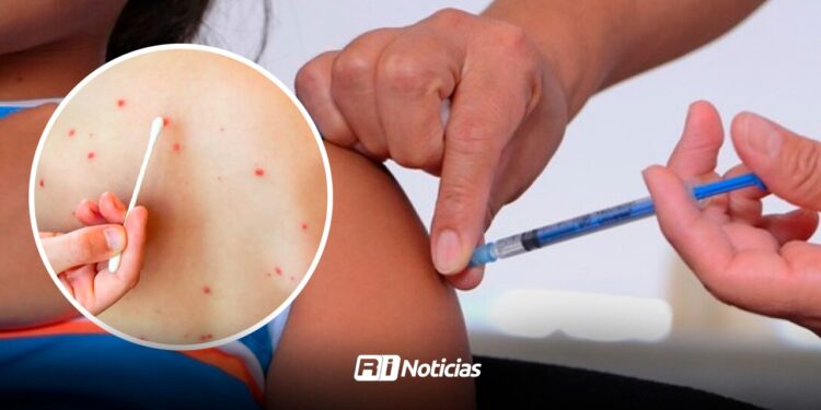 Tras el registro de 13 casos de sarampión en Sinaloa, llaman a vacunar a niños