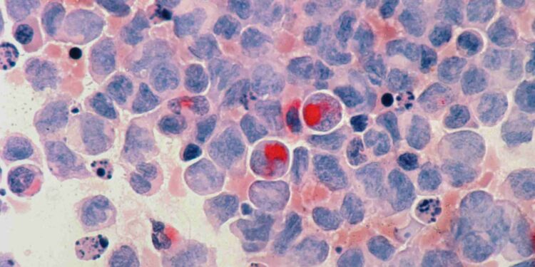 Más de 18 millones de personas en el mundo morirán de cáncer en 2050, un 75% más que ahora