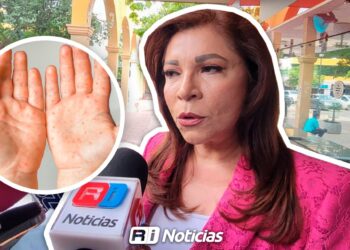 Alerta en primarias de Sinaloa detectan 52 casos de Coxsackie